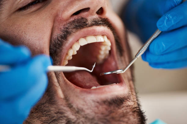 Best Laser Dentistry  in Tenino, WA