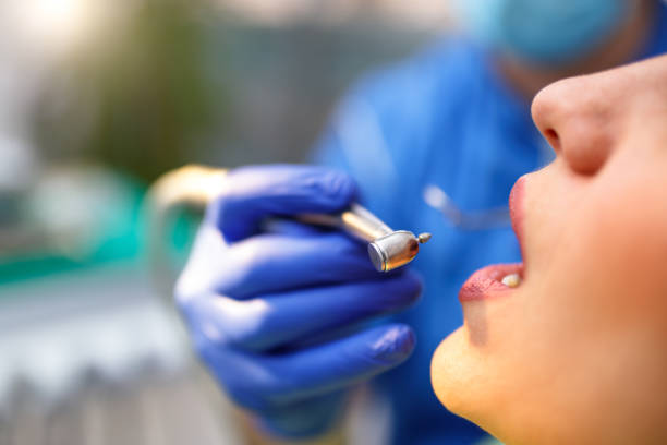 Dental Bonding in Tenino, WA